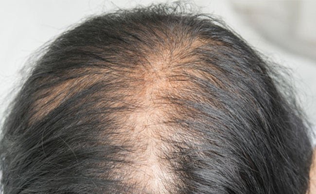 0hna3s3g_things-to-avoid-if-you-have-thin-hair_625x300_23_September_22.jpg